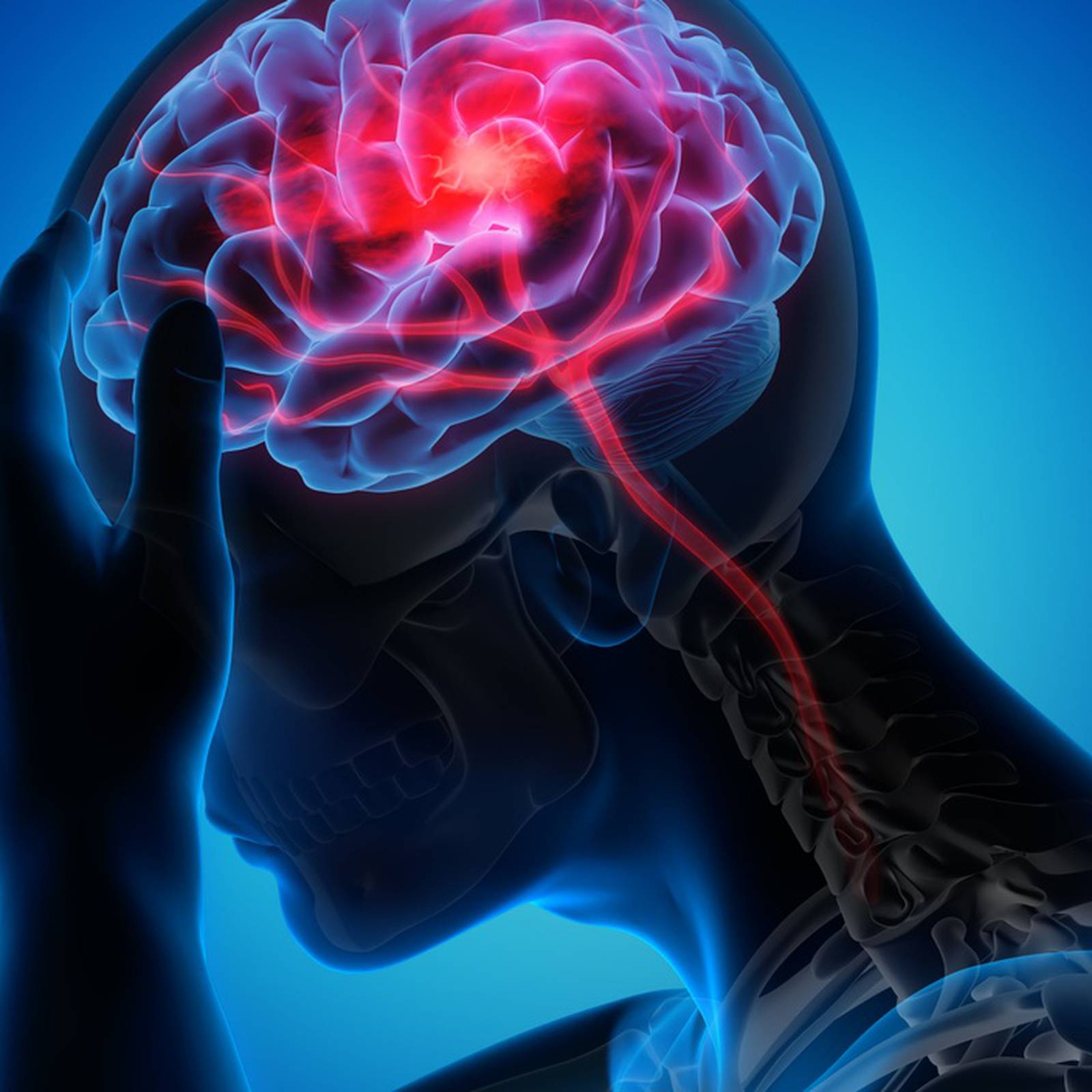 Get the best Brain Stroke Treatment in Aundh